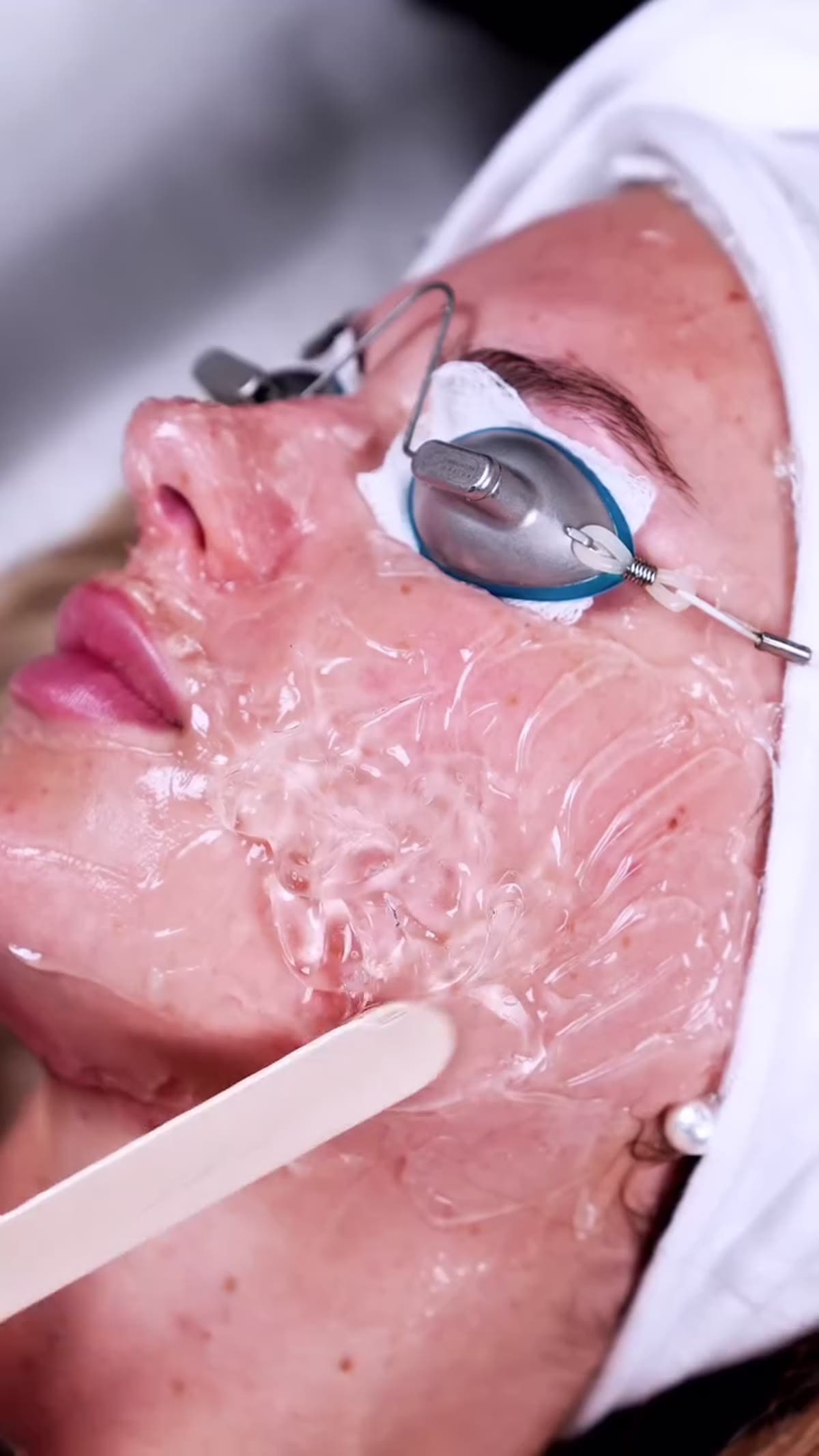 ZO Skin Centre Houston treatment detail