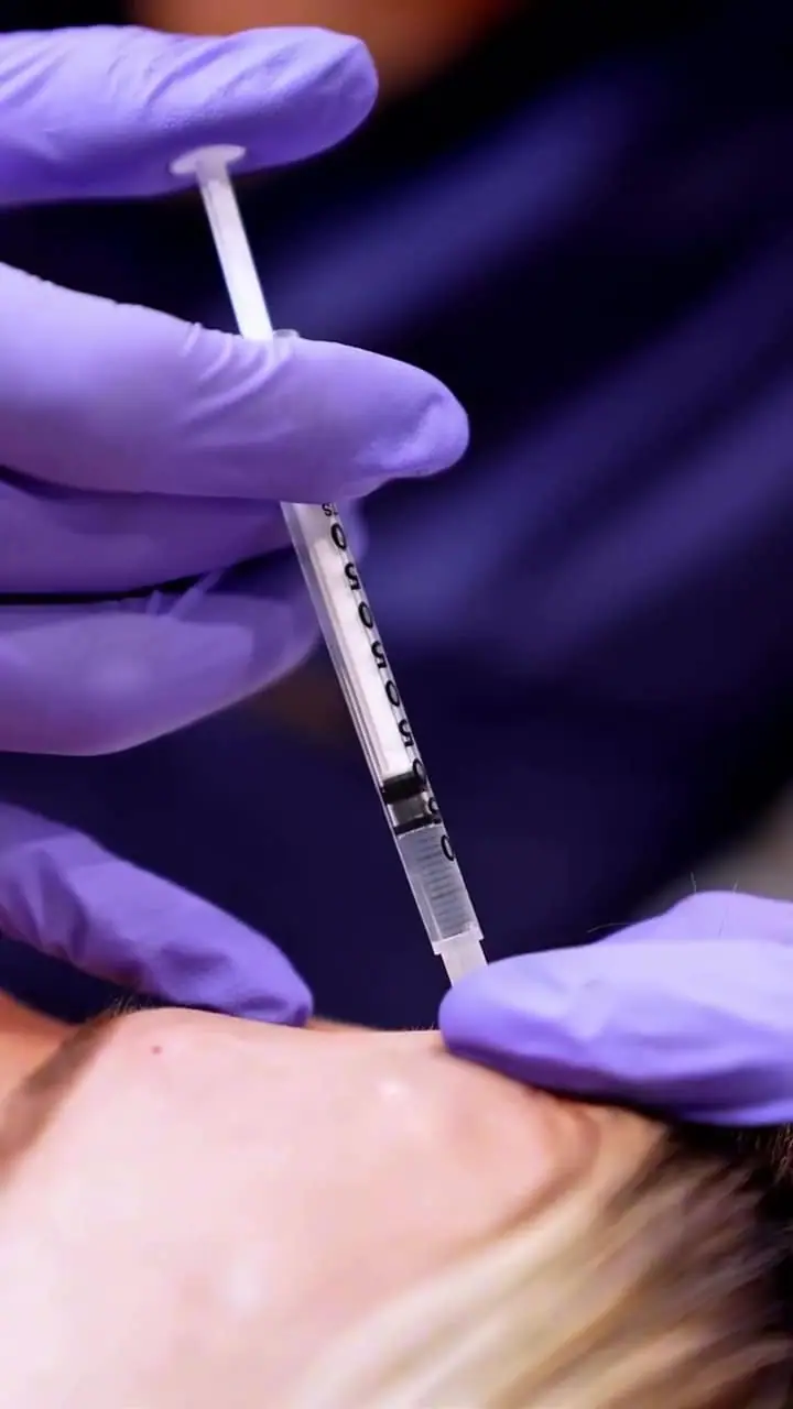 Dysport® treatment detail