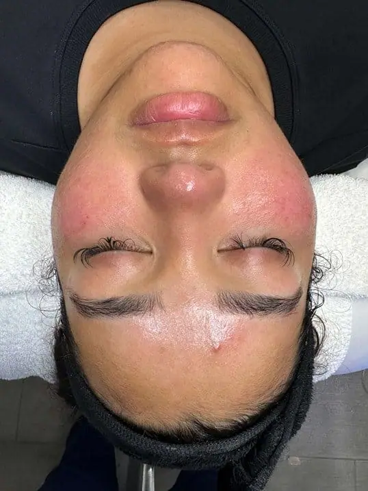 Beautiful Glowing Skin after