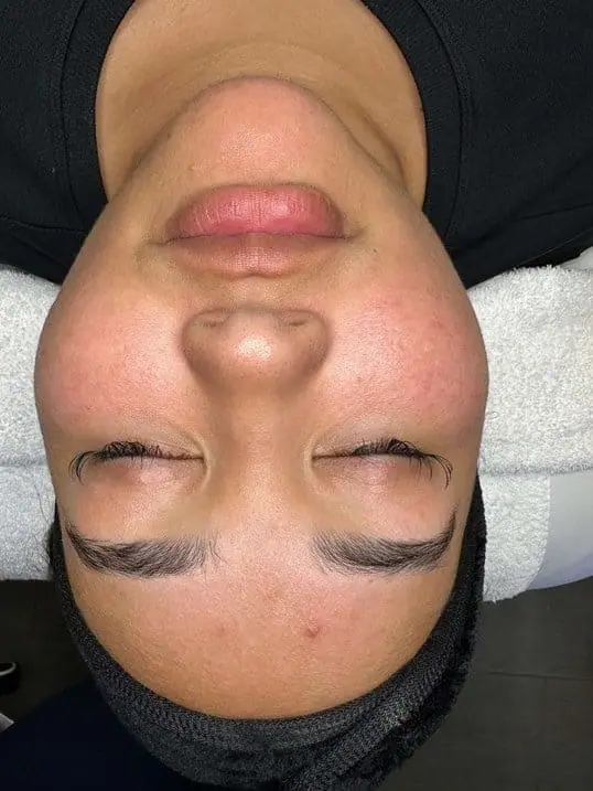 Beautiful Glowing Skin before
