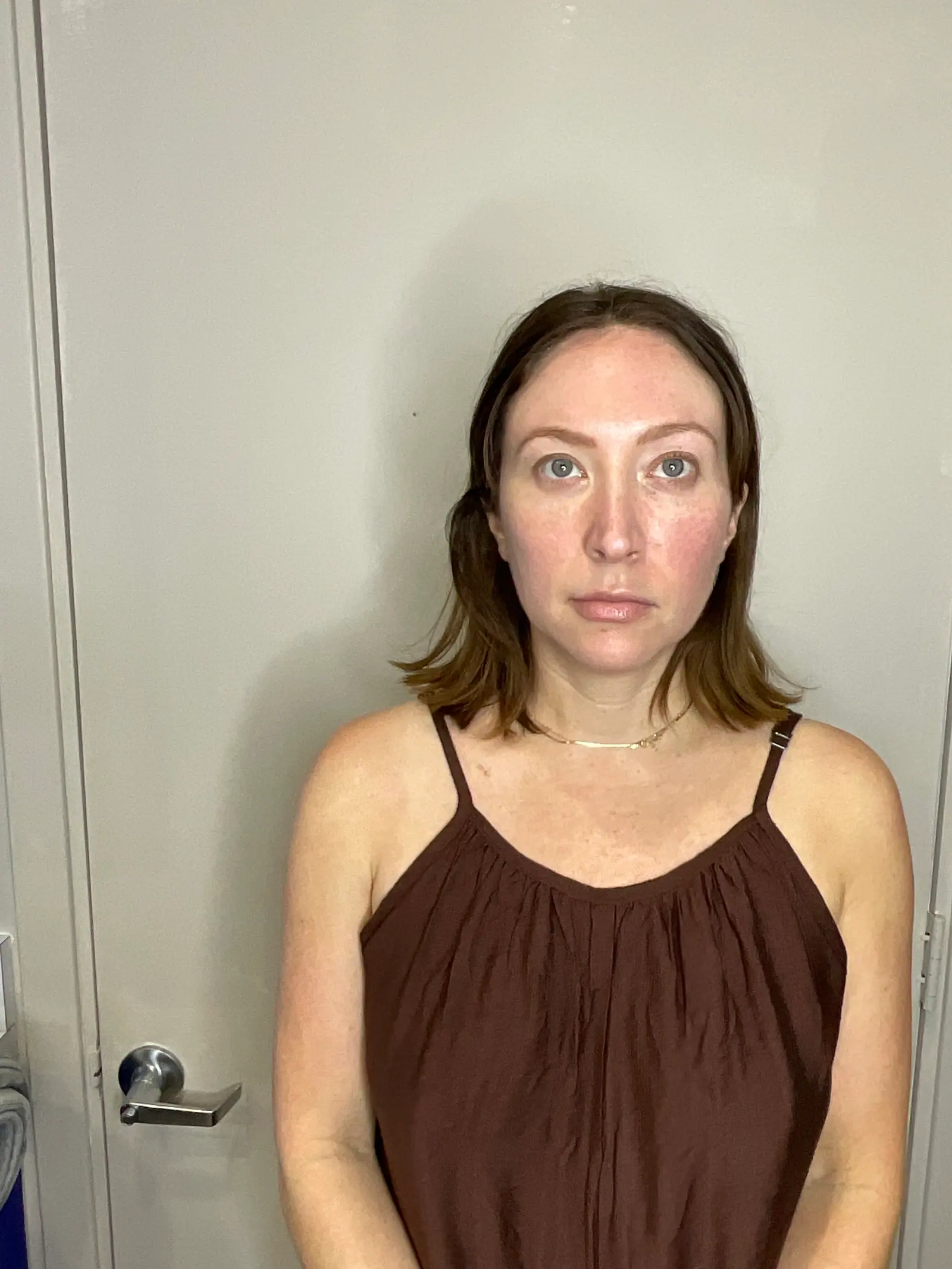 Facial Balancing by Mini after treatment at ZO Skin Centre Houston