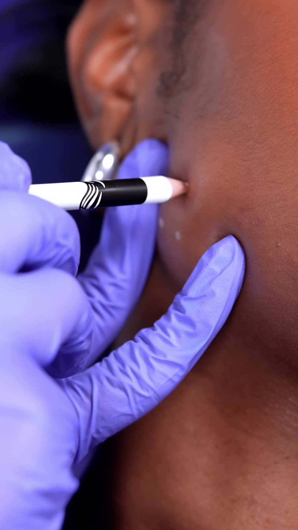Under chin consultation at ZO Skin Centre Houston