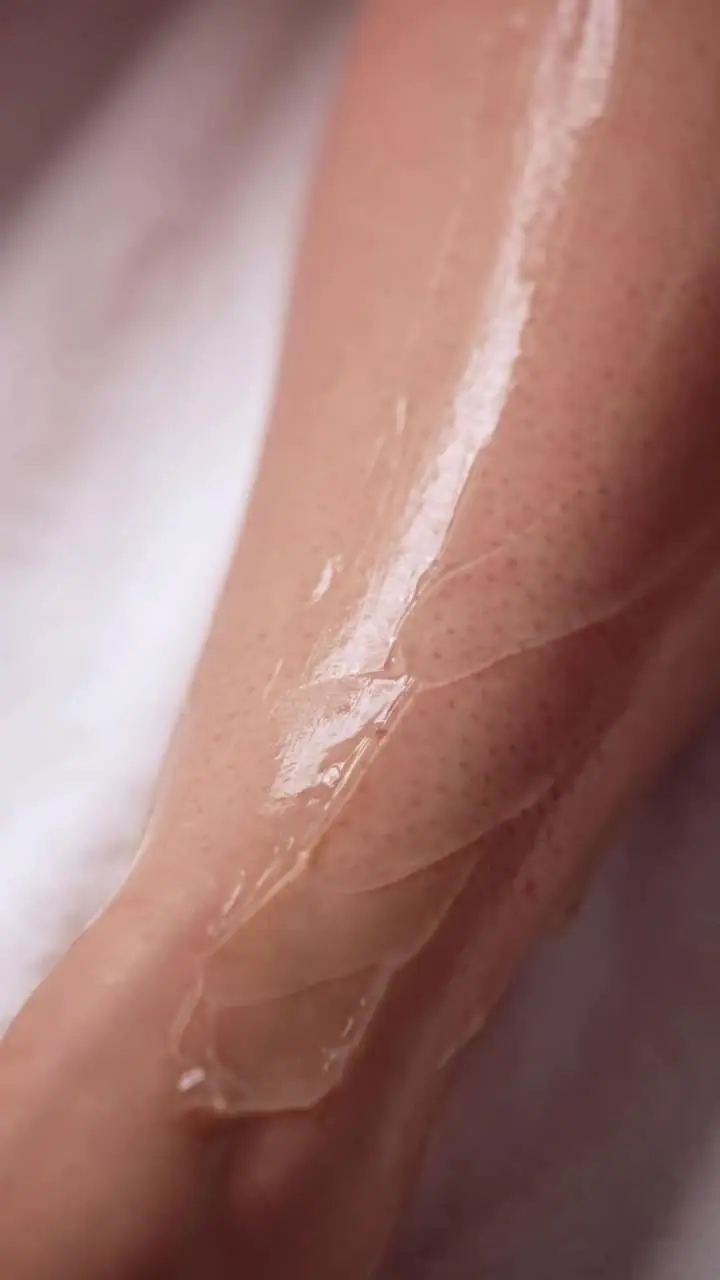Laser Hair Removal treatment detail