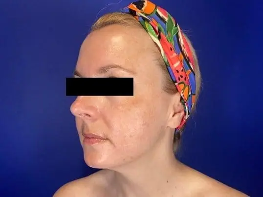 Clear and Brilliant before