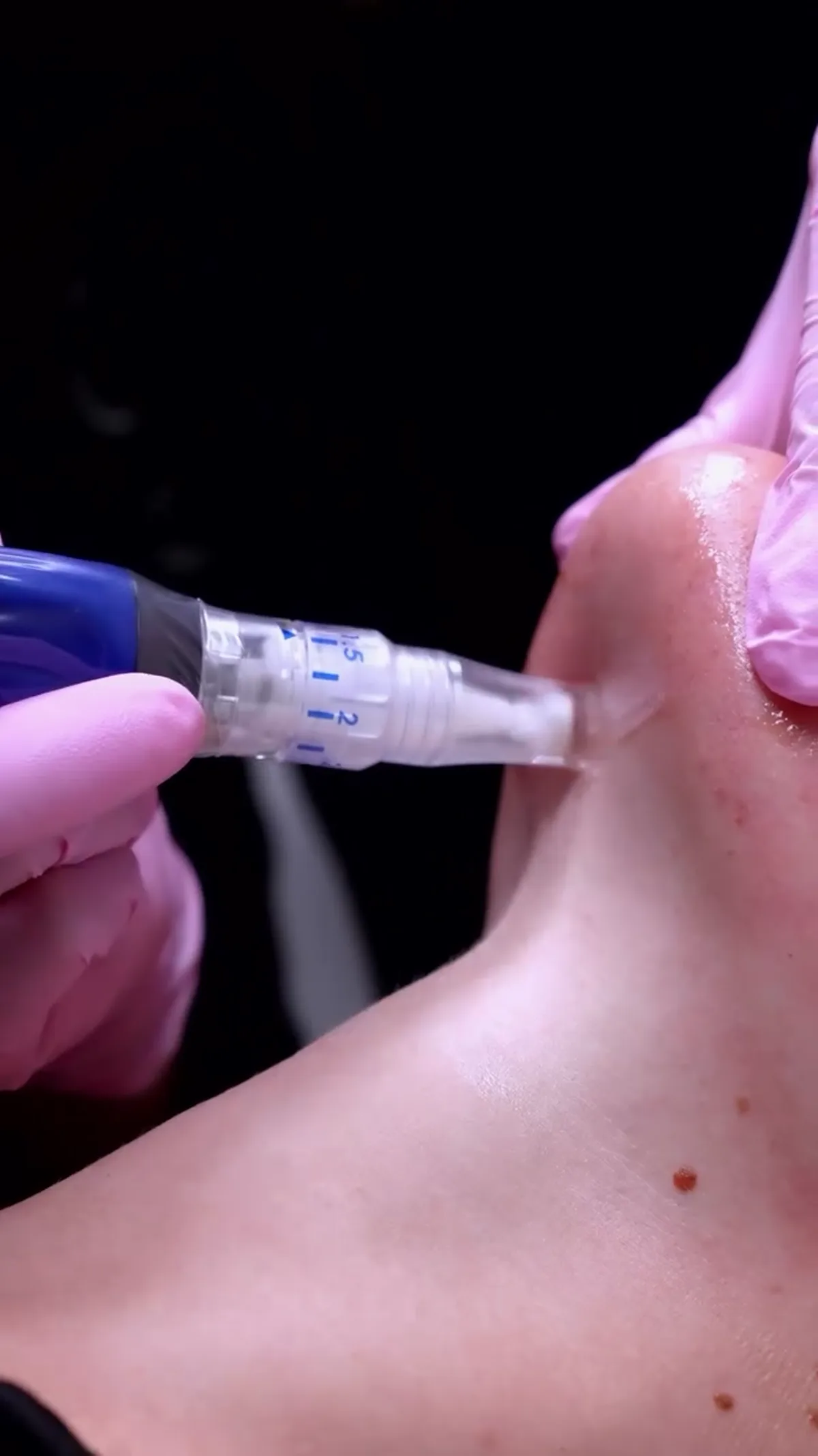 ZO Skin Centre Houston treatment detail