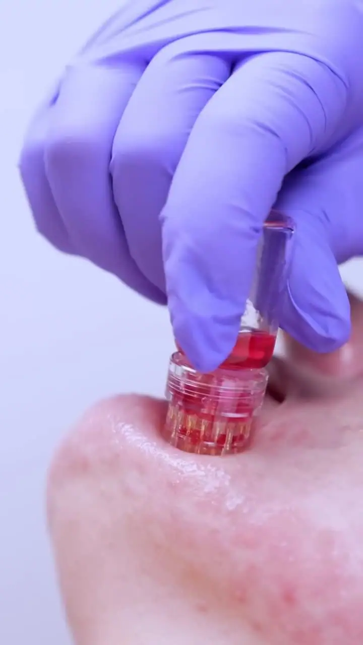 Skin-quality consultation at ZO Skin Centre Houston